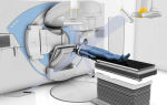 Преимущества и противопоказания использования радионожа в хирургии
