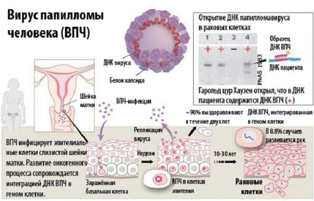 Женские генитальные папилломы на половых органах