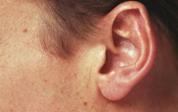 Как избавиться от гнойного прыща в ухе: почему возникает воспаление