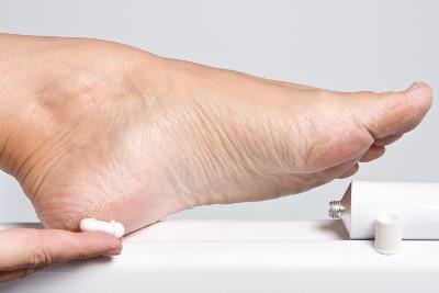 Способы быстро вылечить мозоль на ноге в домашних условиях