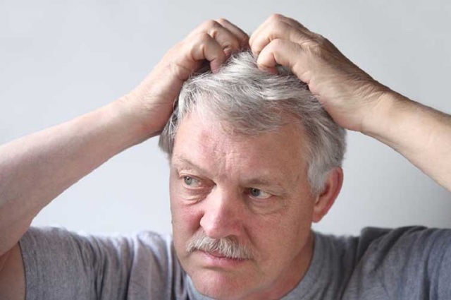 Причины и лечение опоясывающего герпеса на голове в волосах
