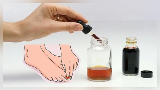 Лечение грибка ногтей уксусом в домашних условиях