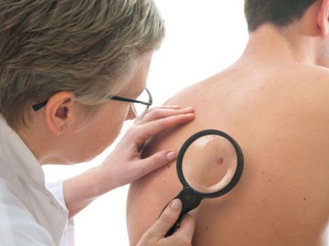 Разновидности и способы лечения наростов на коже человека