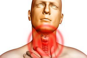Грибок в горле: причины, симптомы и лечение заболевания