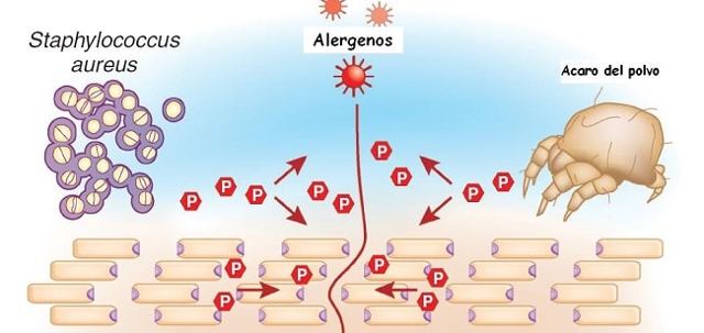 Причины, симптомы и лечение аллергического дерматита