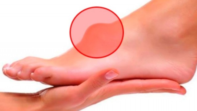 Безболезненное удаление фибромы под кожей на ноге