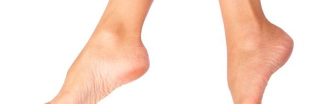 Шипица на пальце ноги: причины, симптомы и лечение