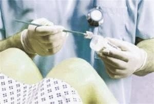Лечение остроконечных кондилом во влагалище и внутри матки